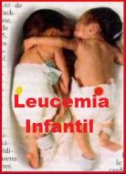 LEUCEMIA INFANTIL